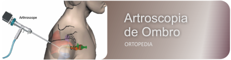 Artroscopia Ombro